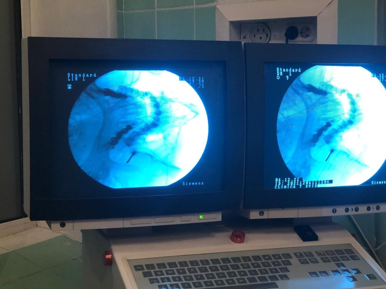 Лікування невралгії трійчастого нерва — фото 1